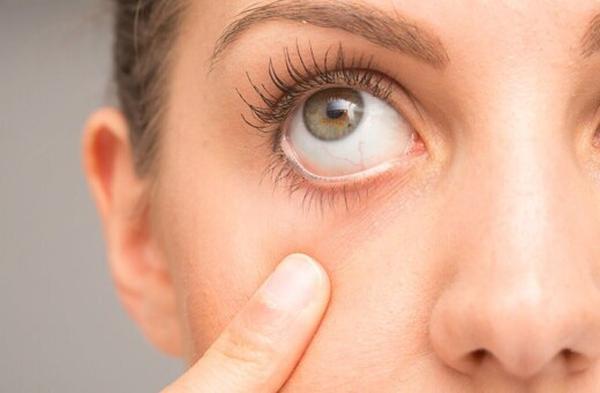 چند ویتامین مهم برای یاری به حفظ سلامت چشم