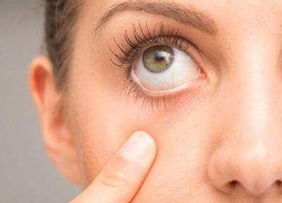 چند ویتامین مهم برای یاری به حفظ سلامت چشم
